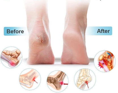 Silicone Heel Pads