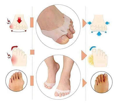 Silicone Toe Separator