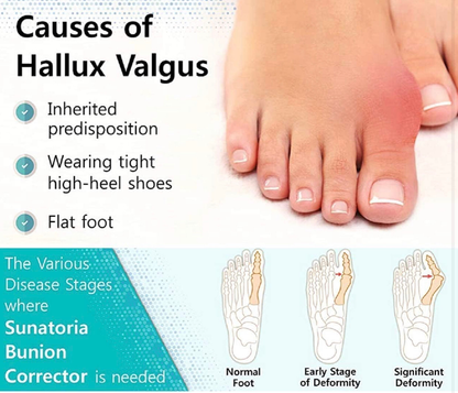 Silicone Toe Separator