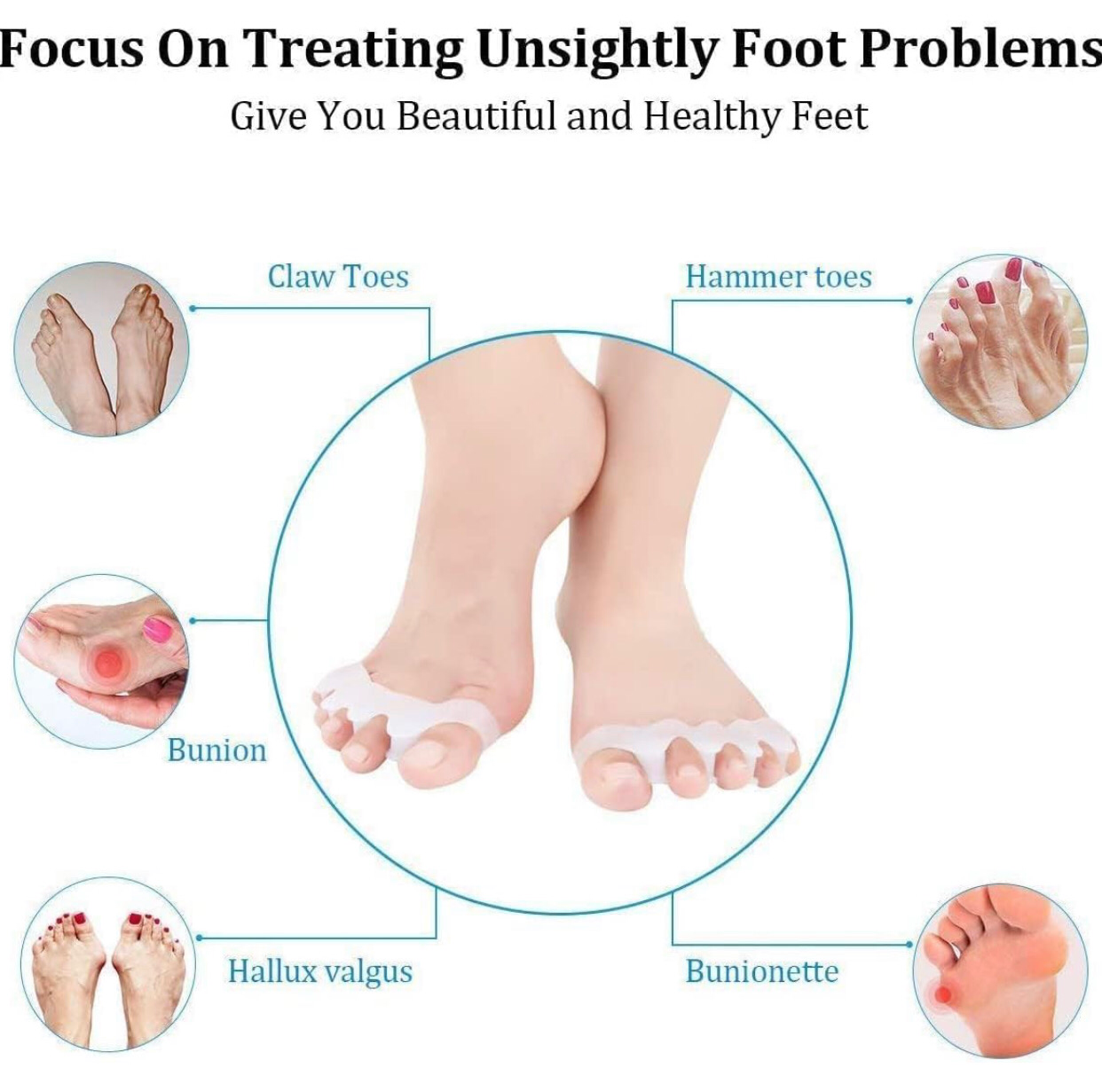 Silicone Toe Separator