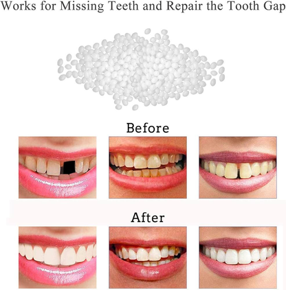 Moldable False Teeth