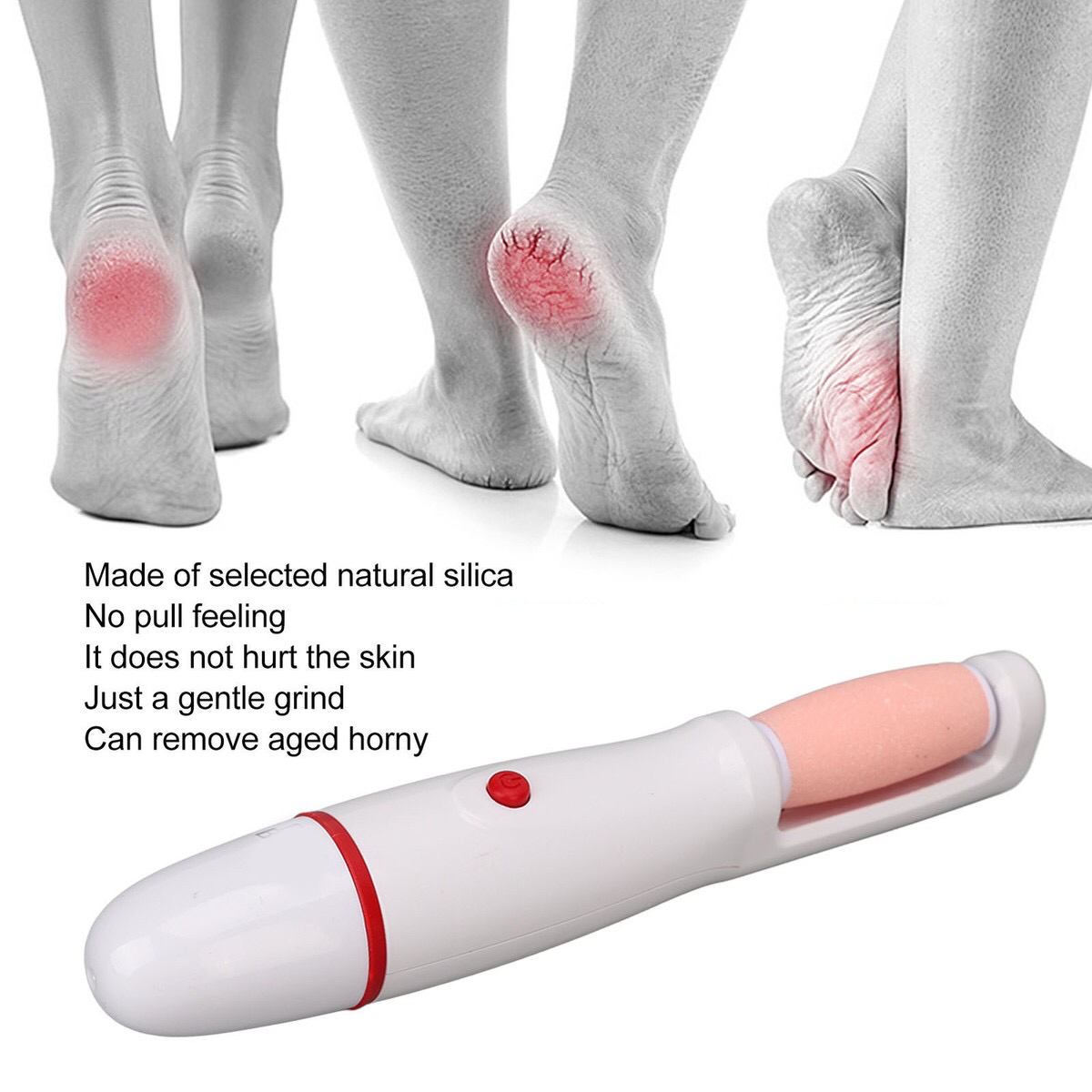 Callus Remover (RF-712)