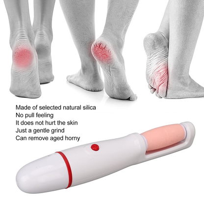 Callus Remover (RF-712)