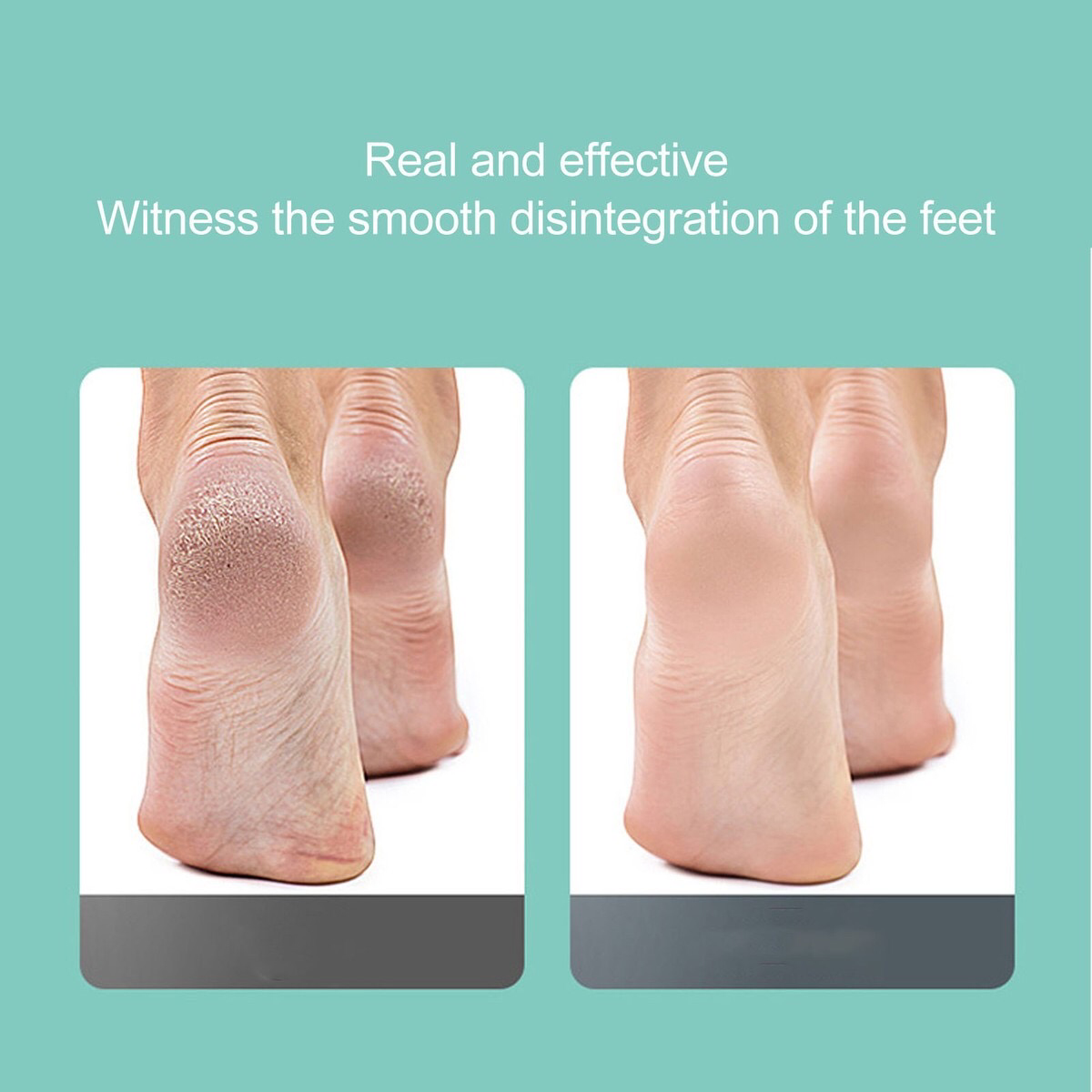 Callus Remover (RF-712)