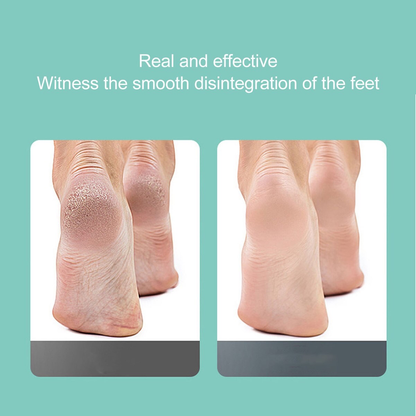 Callus Remover (RF-712)