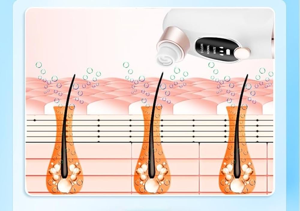 Pore Suction Cleaner