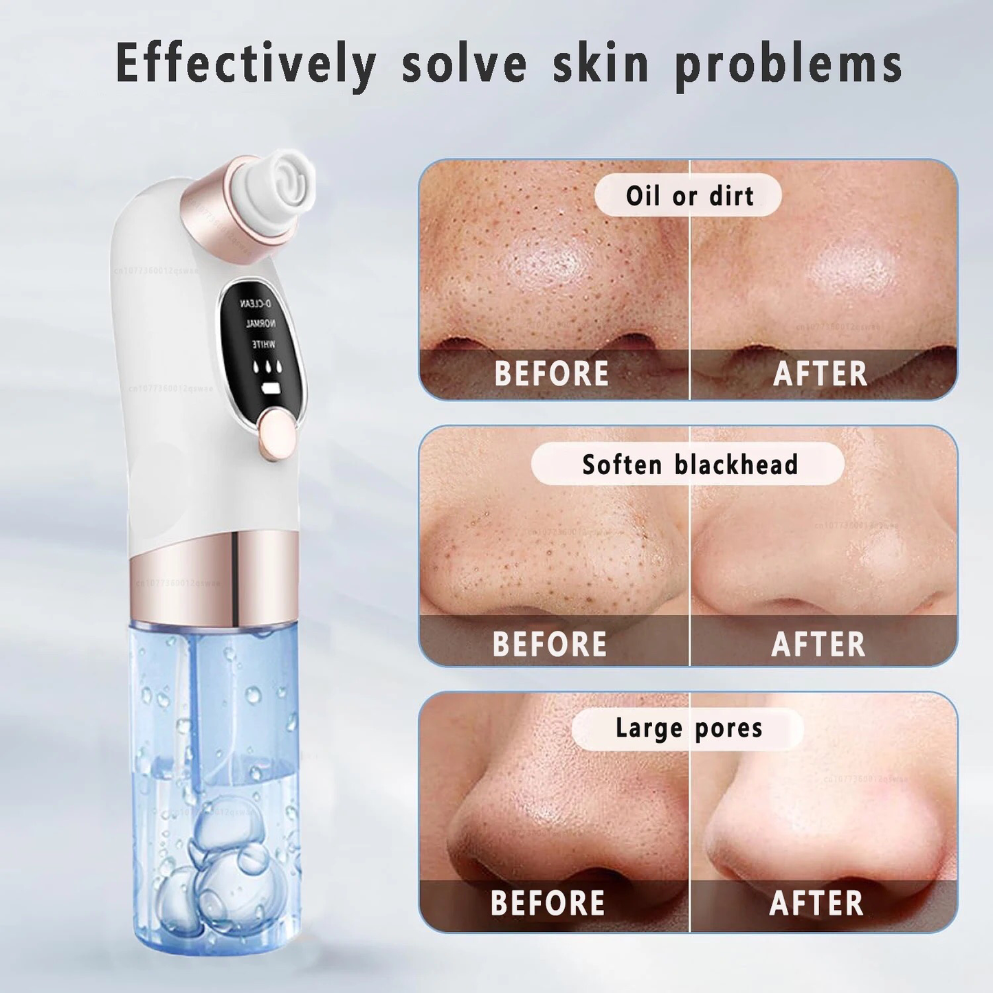 Pore Suction Cleaner