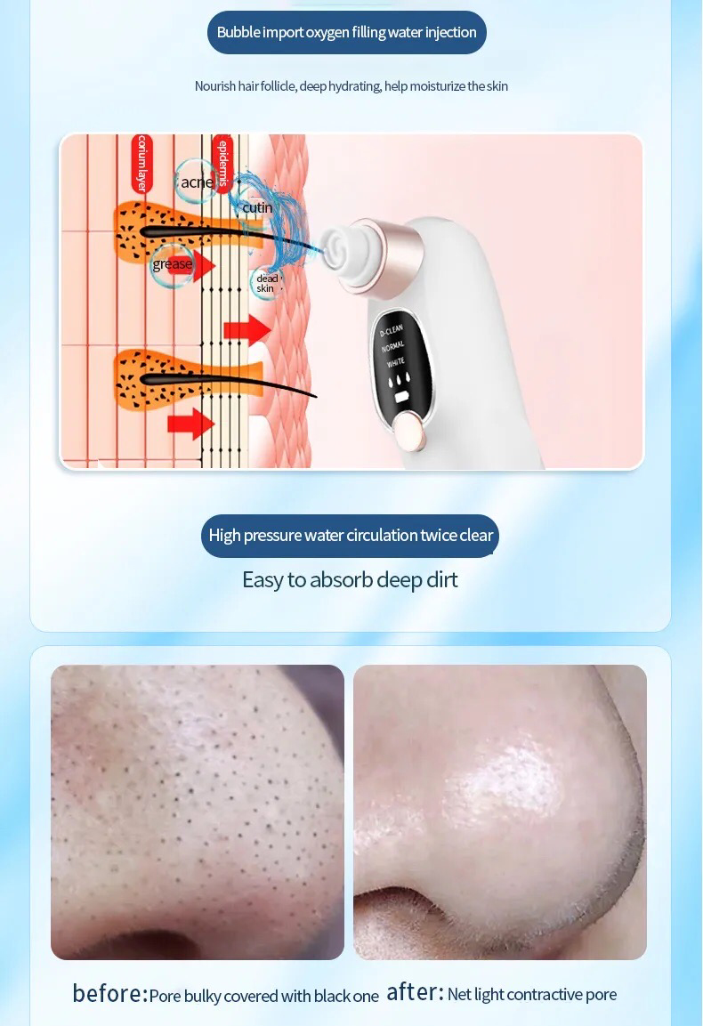 Pore Suction Cleaner